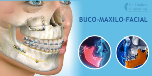 Buco-Maxilo-Facial O especialista da Face